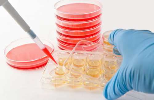 в лечении эндометриоза важно учитывать эти 5 моментов