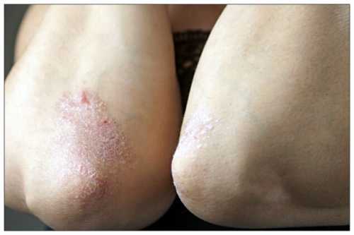 почему нужно учиться спать на спине: преимущество этой позы для сна